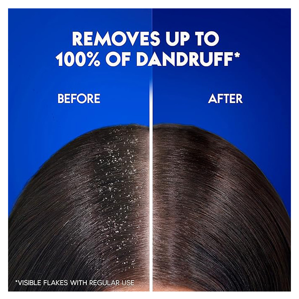 شامبو هيد اند شولدرز تساقط الشعر 600 مل