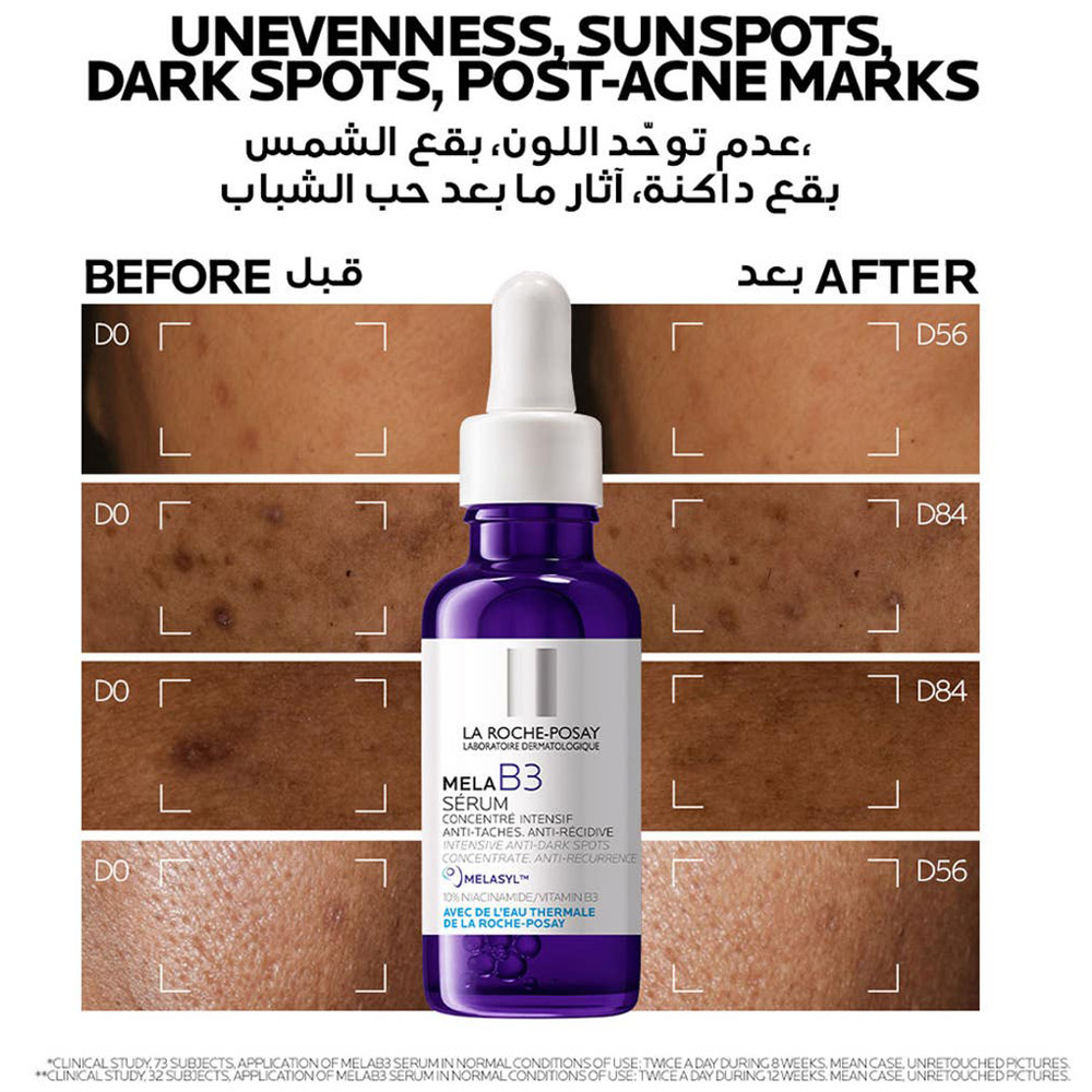 سيروم لاروش بوزيه ميلا بي 3 نياسيناميد المضاد للبقع الداكنة لجميع أنواع البشرة 30 مل